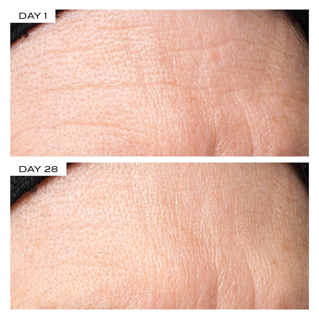 Exosome Face Lift Protocol