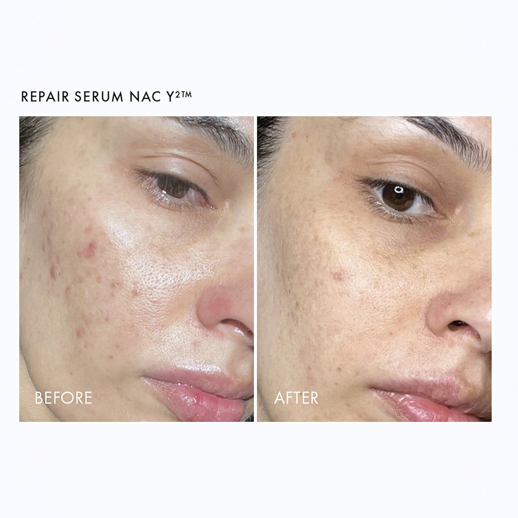 Repair + Renew Routine