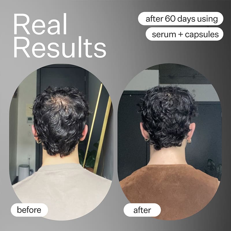 Cold Processed Stem Cell Serum by Act+Acre