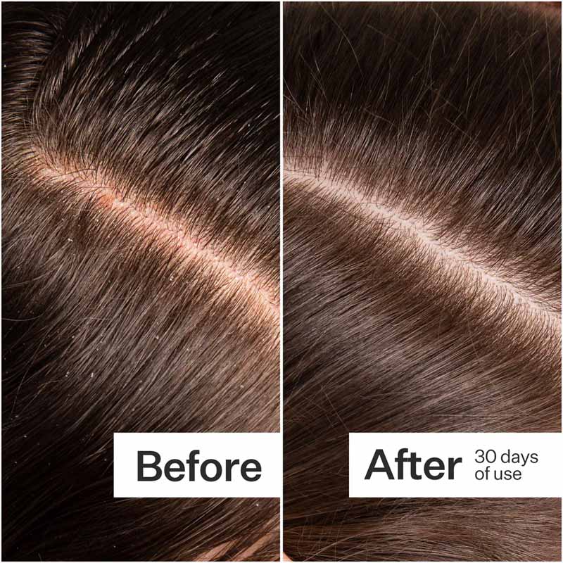 Microbiome Cooling Scalp Serum by Act+Acre