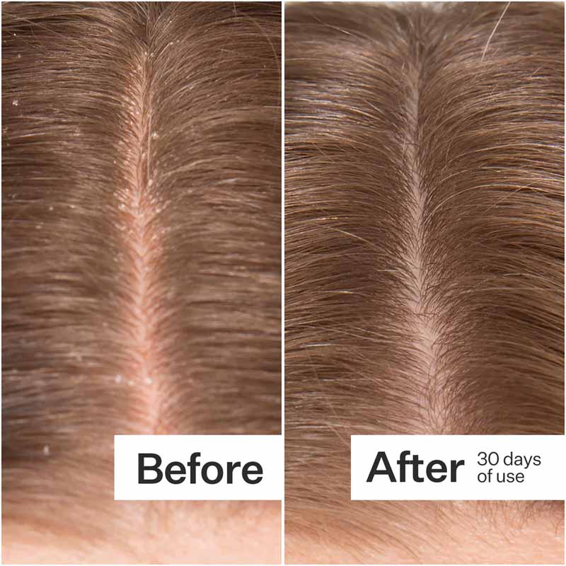 Microbiome Cooling Scalp Serum by Act+Acre