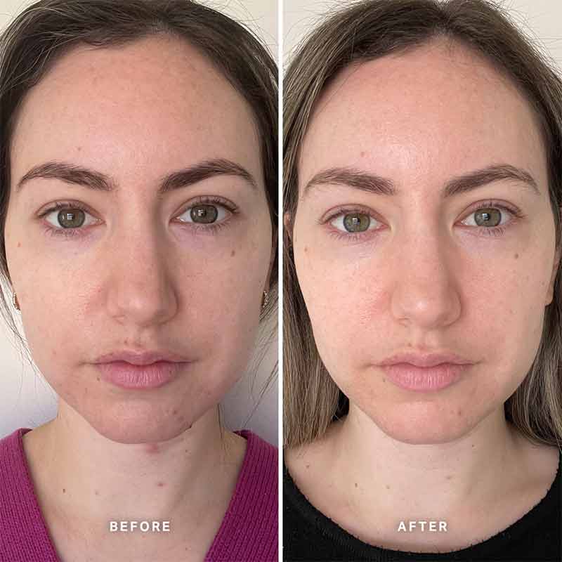 Vitamin B Serum With 5% Niacinamide