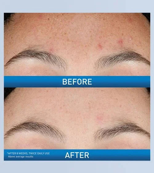 Resurfacing Retinol Serum by CeraVe