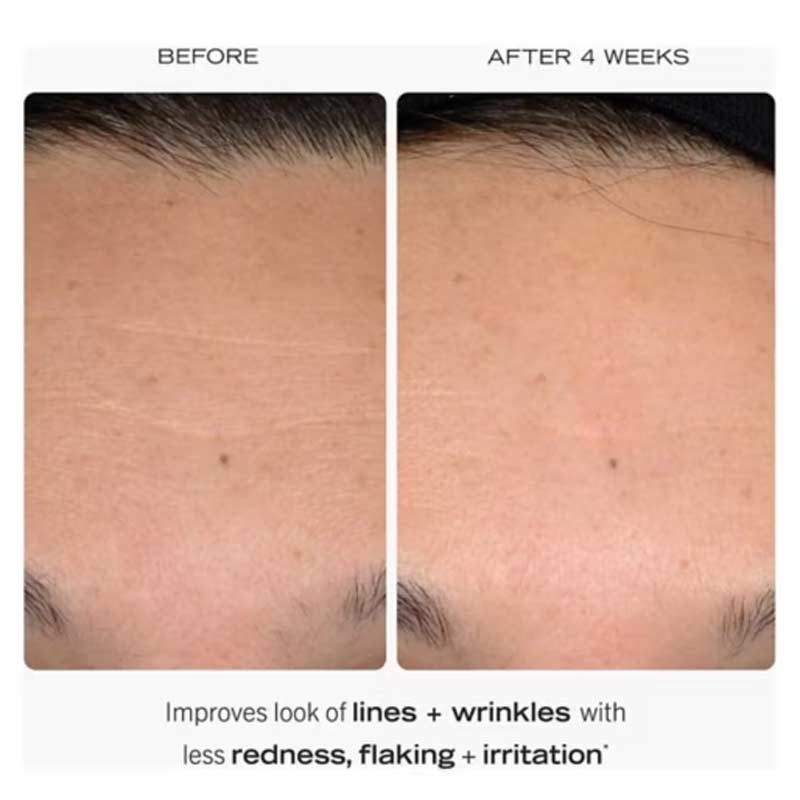 0.3% Retinol Complex Serum With Peptides by First Aid Beauty
