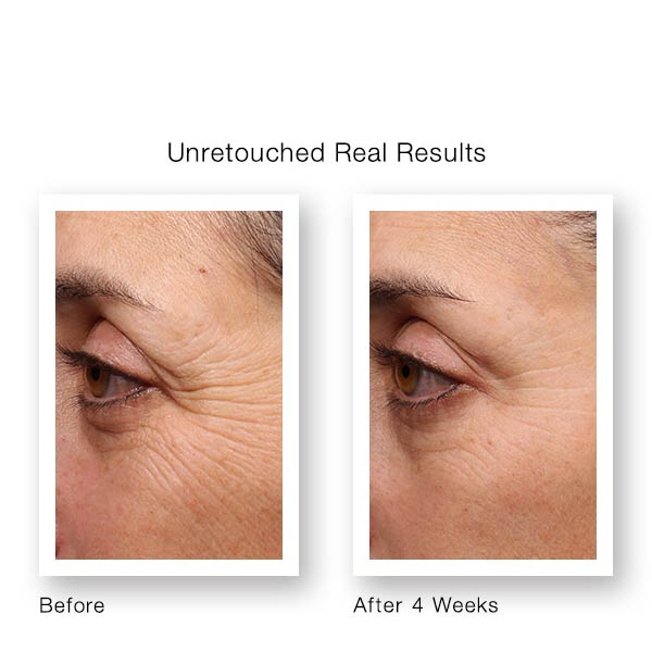 Resurgence Retinol Youth Renewal Eye Serum 15ml