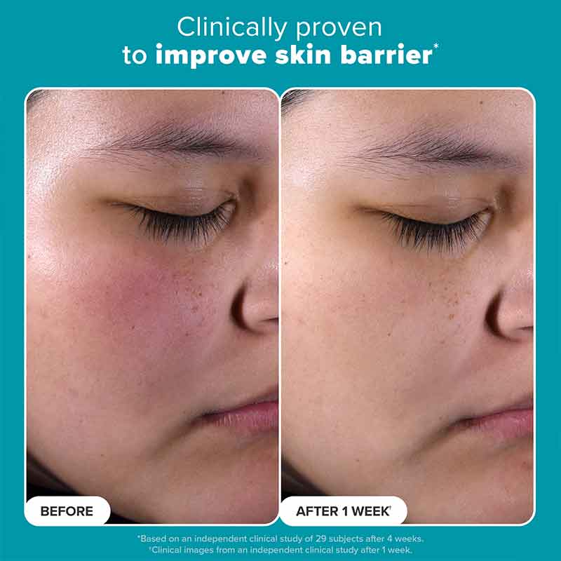 Skin Perfecting 2% BHA Exfoliating Toner + Boost 10% Azelaic Acid