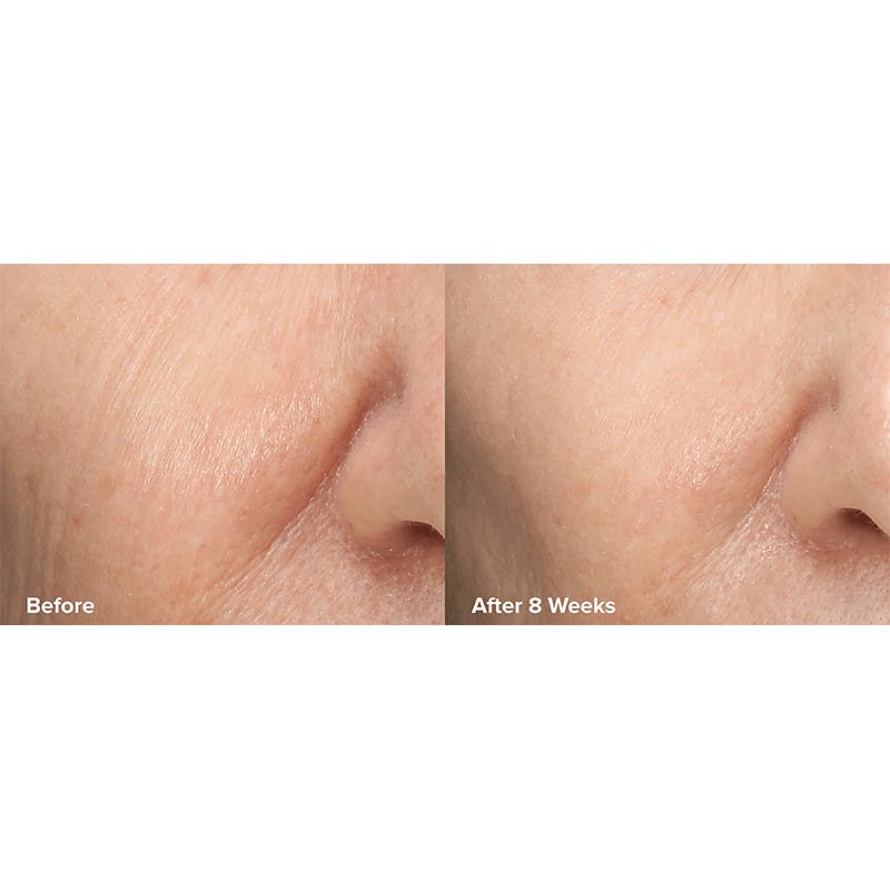 Skin Perfecting 6% Mandelic Acid + 2% Lactic Acid Liquid Exfoliant
