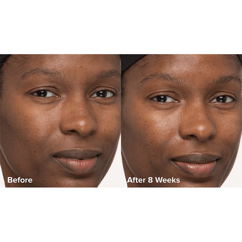Skin Perfecting 6% Mandelic Acid + 2% Lactic Acid Liquid Exfoliant Travel Size by Paula's Choice