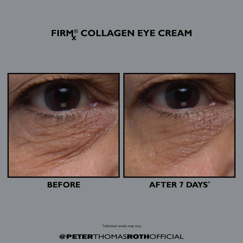 Firmx Collagen Eye Cream by Peter Thomas Roth