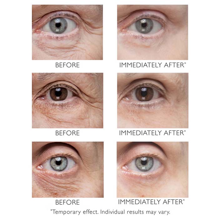 Instant FIRMx Eye 30ml