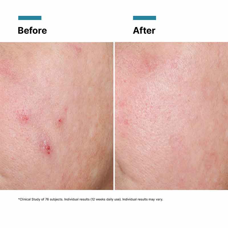 Advanced RGN-6 Aesthetic Recovery Cream by SkinCeuticals