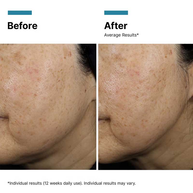 A.G.E. Interrupter Ultra Serum by SkinCeuticals