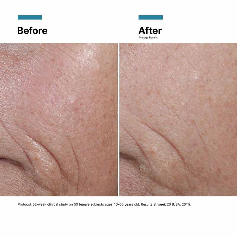 C E Ferulic 15% L-Ascorbic Acid