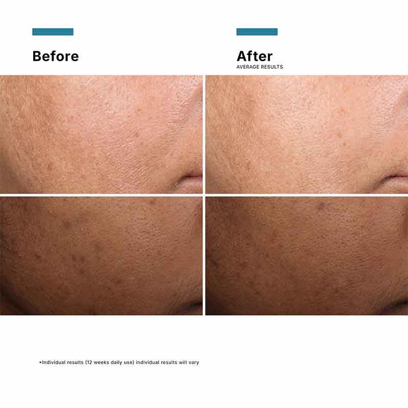 Discoloration Defense Serum 30ml