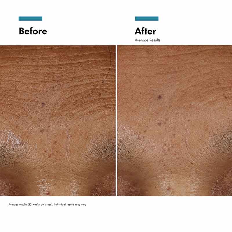 HA Intensifier Multi-Glycan Hyaluronic Acid Serum by SkinCeuticals