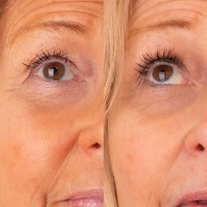 Lash Lift Mascara & Eyelash Growth Serum Set